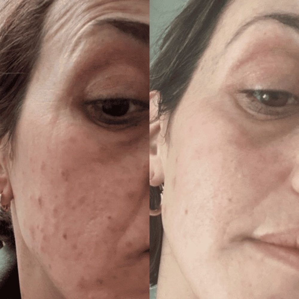 NEW‼️ 10% Vitamin C + Squalane Repair Cream - Hyperpigmentation, Acne, Wrinkles - Picture 10 of 11